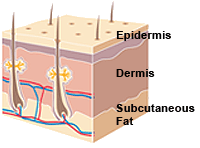 Epidermis