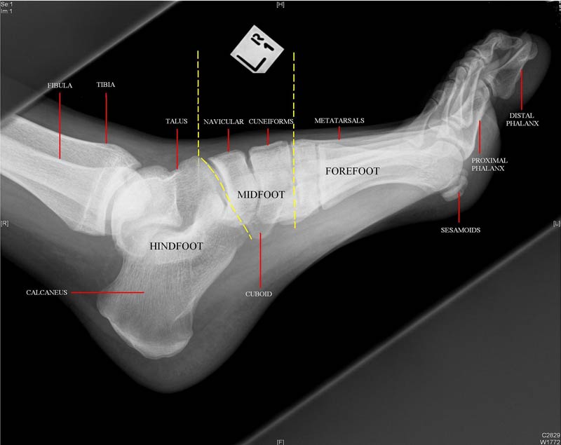 Bones of the foot